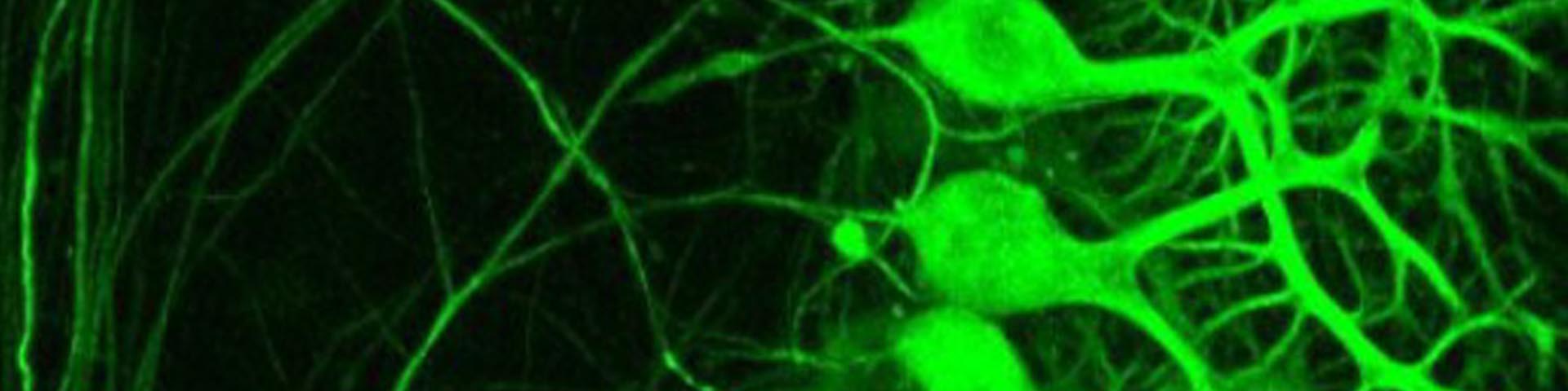 Lab image from a microscope