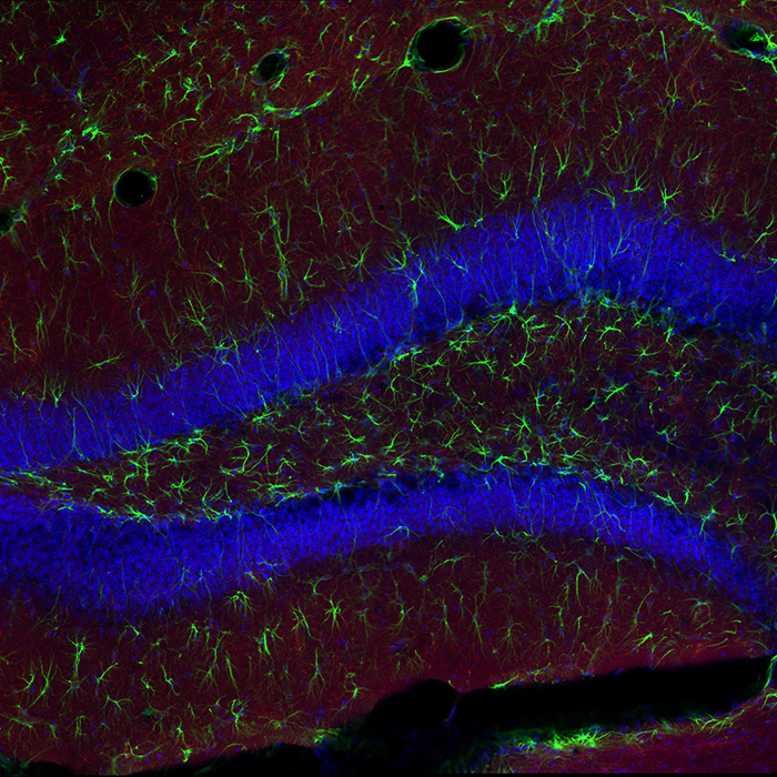 Hippocampal granule cells