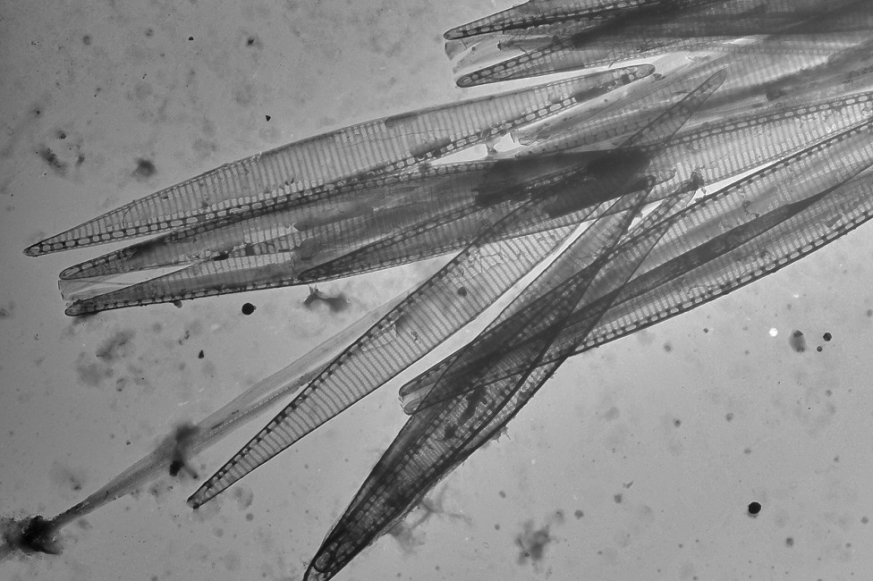 Diatom, Algae, Indian River Lagoon, Transmission Electron Microscopy, Cells, Neurotoxin, Domoic Acid 