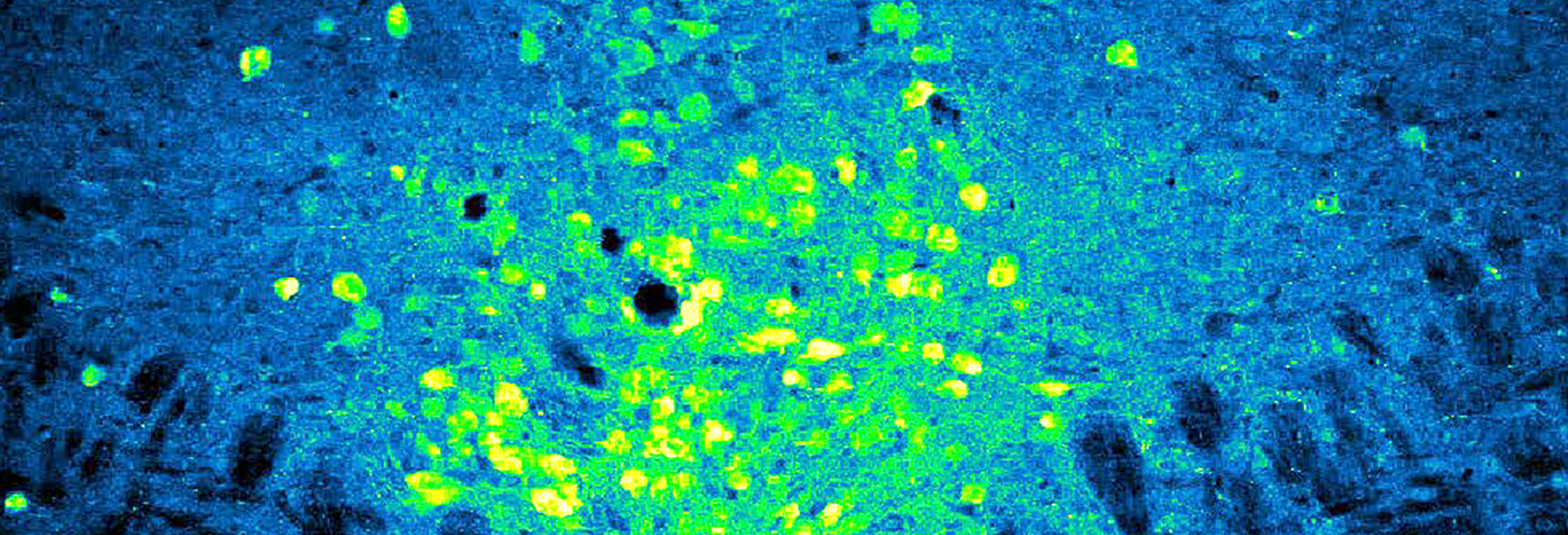 blue and green image of mouse brain