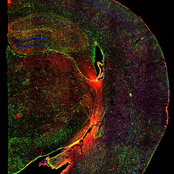 2023 photo contest Greasy Brain 