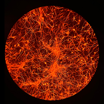 Sixth Annual photo contest Huntington's Disease