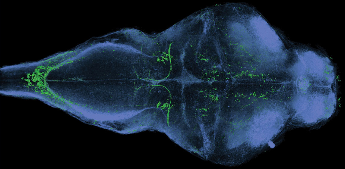 通过神经科学图像讲述故事